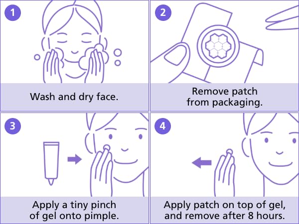 EasyDerm Magnesium Pimple Patches – Hydrocolloid Acne Spot Treatment with Ampoule & Tweezer, 10 Calming Zit Stickers by Daewoong, 이지덤, 대웅제약
