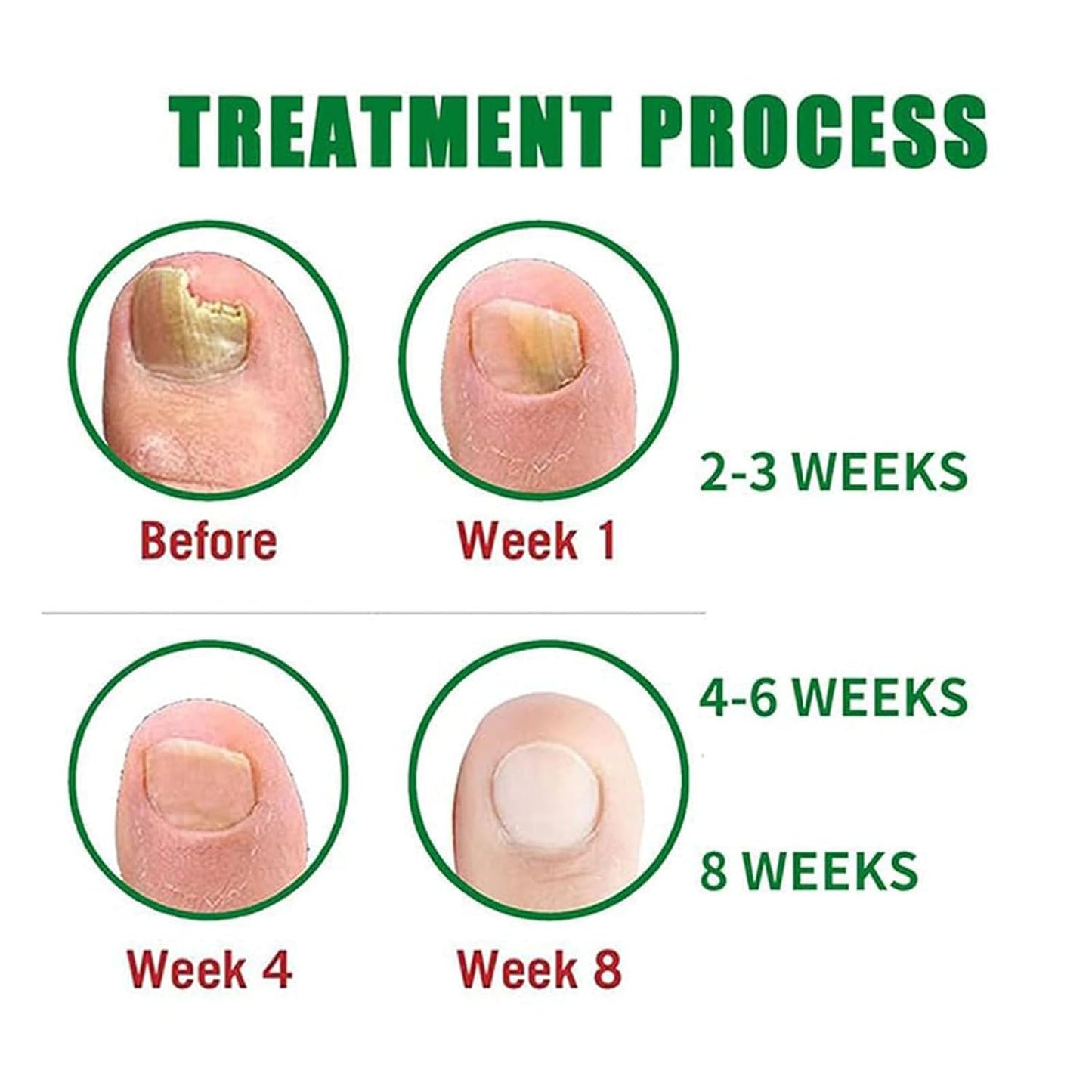 Nutraboost Nail Treatment, Nail Growth Serum for Repair & Strengthener,Multi-Purpose Nail Repair Oil Serum (1)