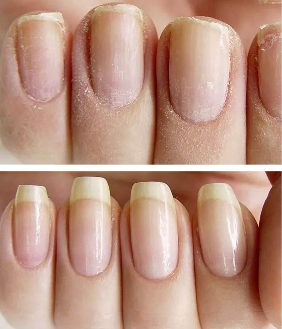 NAILVIVE Nail Serum Powerful Magic-like Silk Proteins Proven Natural Formula Strengthening Hardening nails Instantly Prevents Splits Chips Peels Cracks on Your Nails (BOTTLE APPLICATOR)