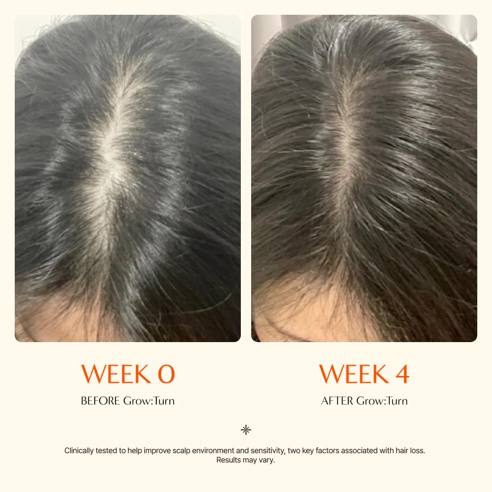 Growturn Hair Growth Serum with Built in Brush for Hair Growth & Thickening | Treatment for Thinning Hair, Hair Loss | Low Irritation, Fragrance-Free, Sulfate & Paraben-Free, 3.38 fl. oz. (Pack of 1)