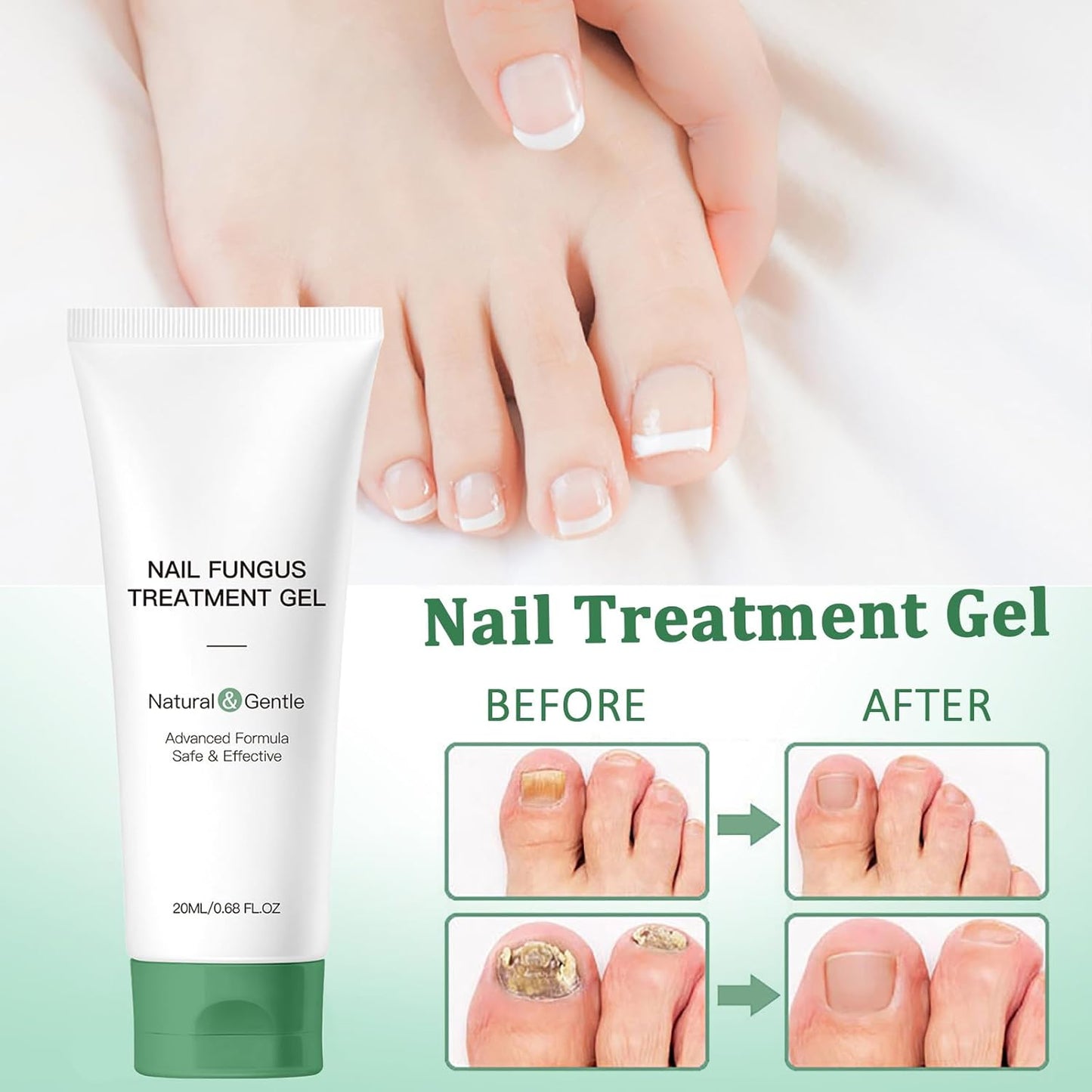 Nutraboost Nail Treatment Gel, Nail Growth Serum for Repair & Strengthener, Multi-Purpose Nail Repair Serum (1)