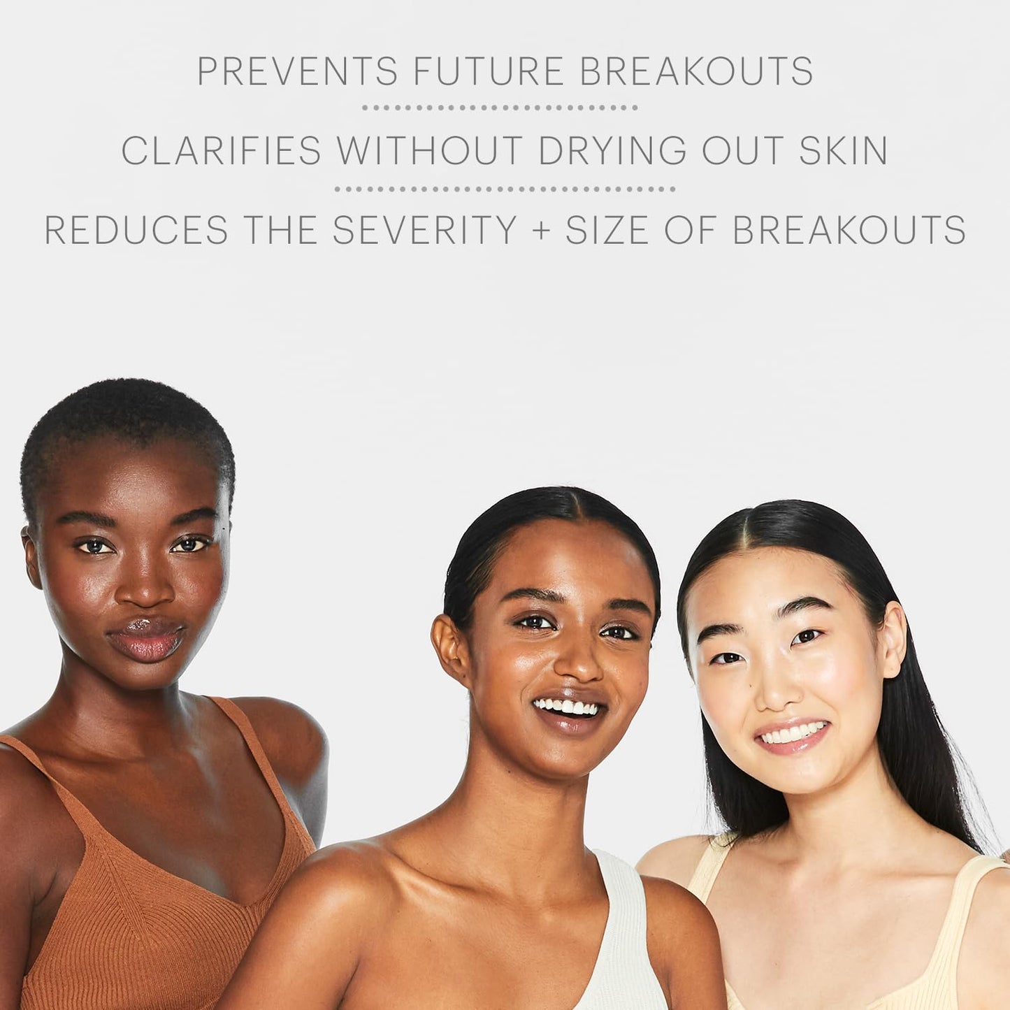 Glo Skin Beauty Acne Spot Treatment - With 5% Sulfur Targets Breakouts For Acne-Prone and Oily Skin