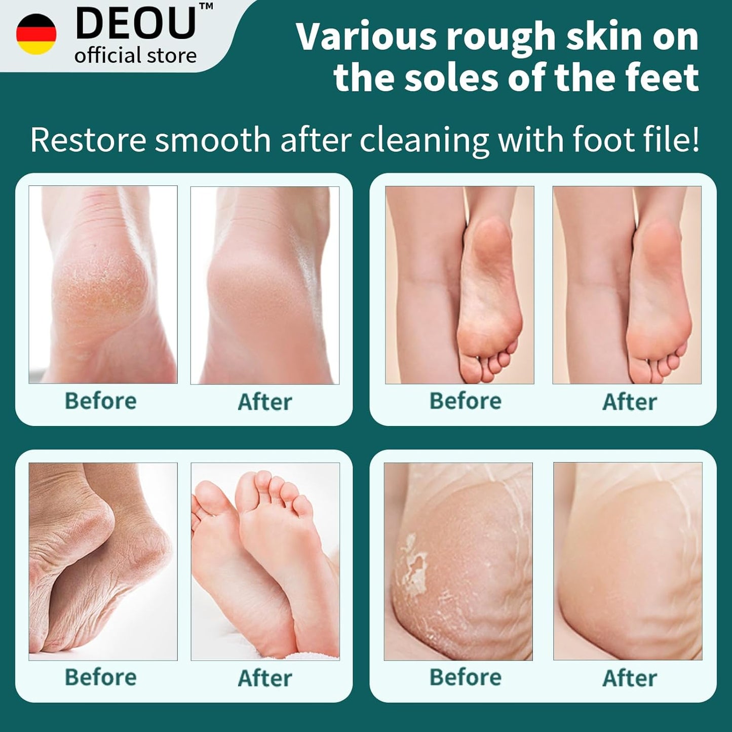 Metal Foot File SStainless Dead Skin Callus Remover for Dead Skin Professional Secure Foot Scrubber Heel Scraper Cracked Heels Repair Pedicure Tools for feet