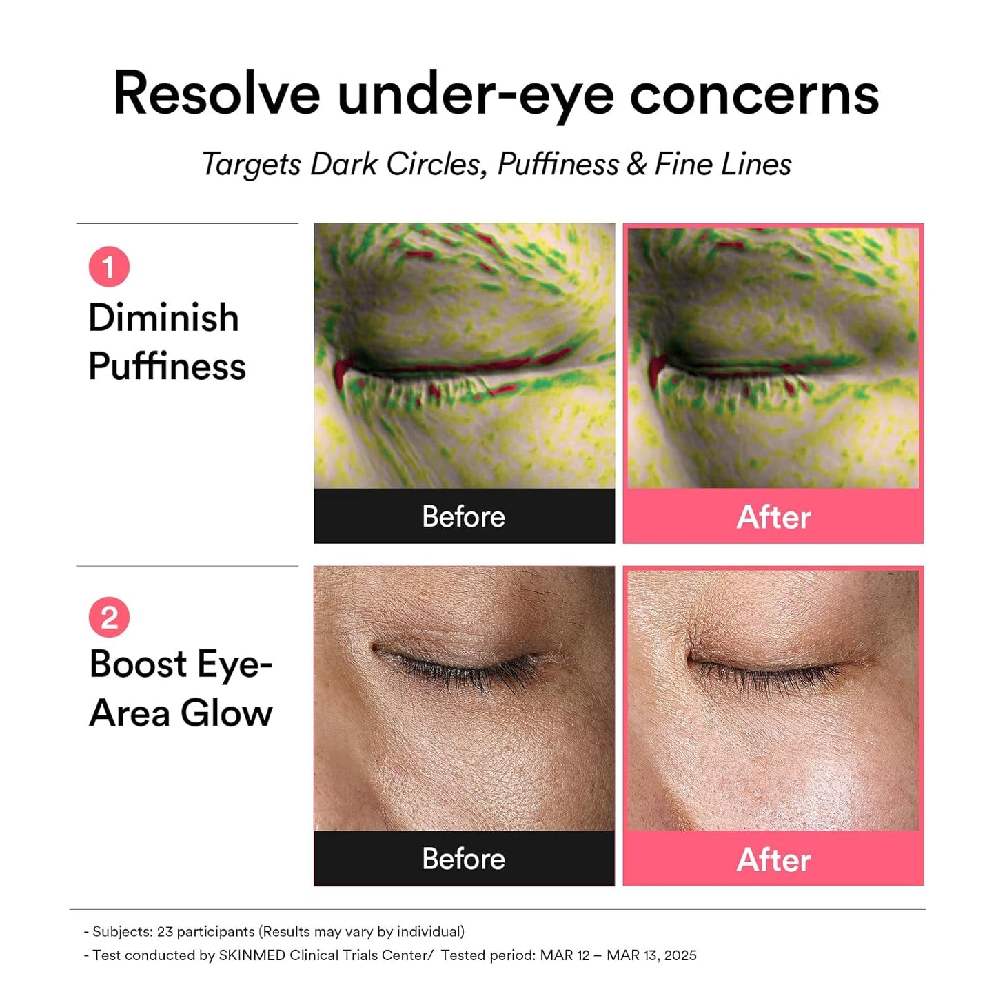 Abib PDRN Retinal Eye Patch Glow jelly 60 Patches, Korean Under Eye Patches for Puffy Eyes and Dark Circles, Anti-Wrinkle, Collagen, Caffeine, Niacinamide