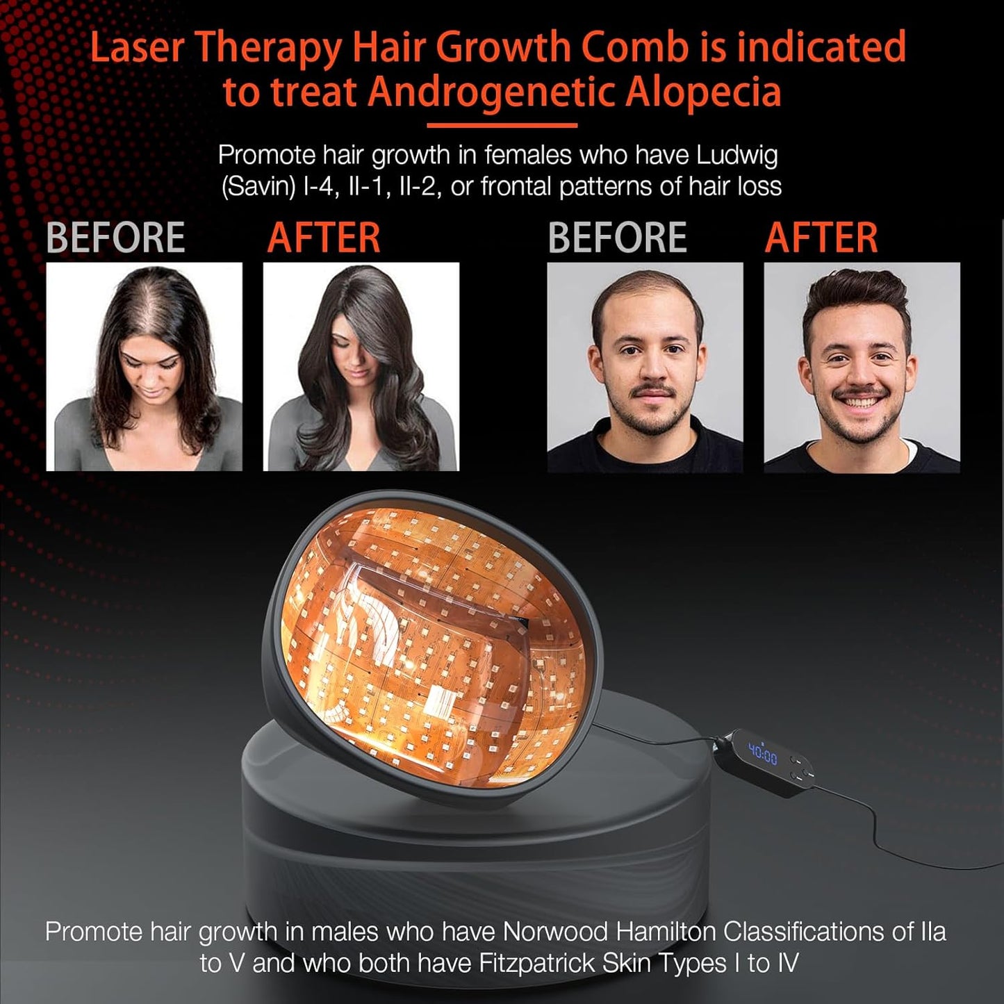 Laser Cap (FDA Cleared), Professional Medical Grade Lasers Hair Growth Treatment Product for Men & Women, Red Light Therapy for Hair Growth, Treat Alopecia