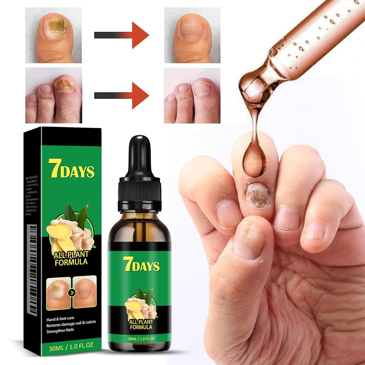 3Pcs Ginger Nail Serum, 2-in-1 Serum Repair Essence, Ginger Care Oil for Nails Strengthener Oil, Care Moisturizer