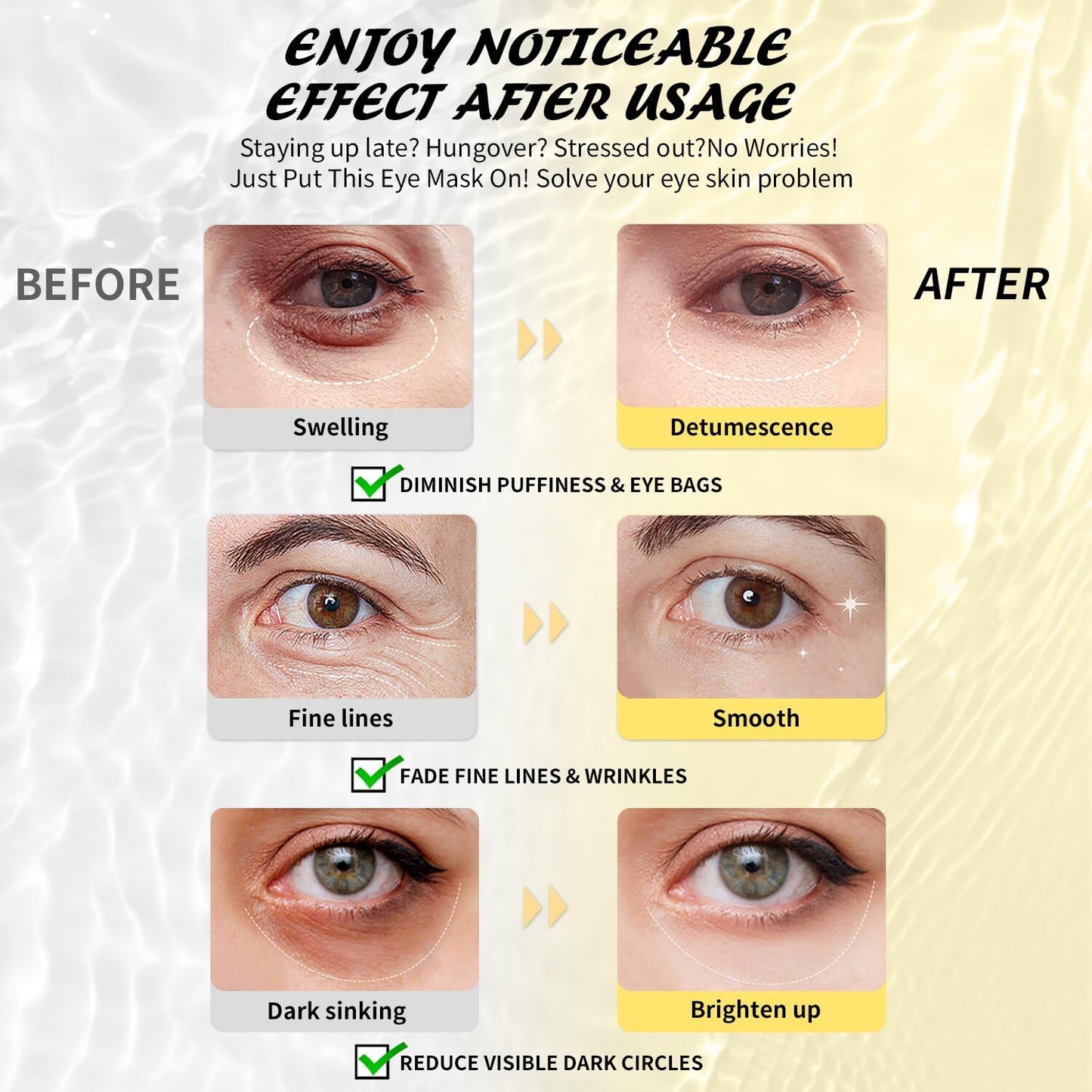 Under Eye Patches (25 Pairs), Hyaluronic Acid Eye Masks for Dark Circles Puffy Eyes Undereye Bags, Collagen Eye Patches for Wrinkles and Hydrate, Skin Care Gift for Her
