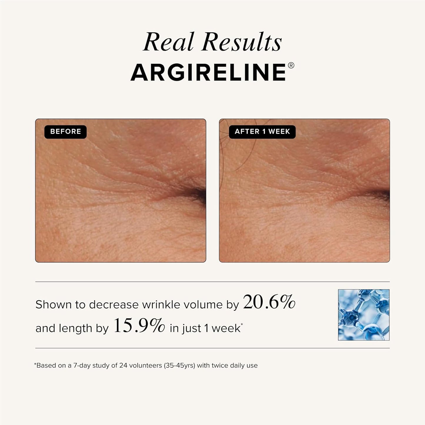Asterwood Triple Repair Matrixyl 3000 + Argireline + Hyaluronic Acid + Vitamin C Serum for Face - Anti-Aging, Collagen Boosting, Hydrating - Fragrance-Free - 2 Fl Oz
