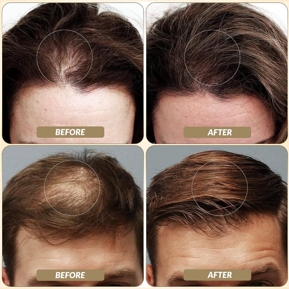 SOVONCARE Hair Fibers for Thinning Hair Dark Brown, Hair Building Fibers for Bald Spots Undetectable & Natural, Conceals Hair Loss, Fill In Fine Hair Powder Hair Thicker Instantly for Women & Men 28g