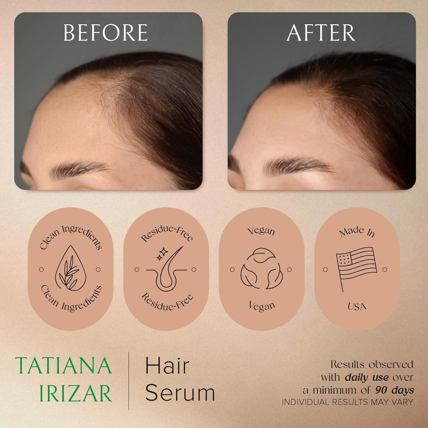 Hair Serum for Hair Growth Serum Women Made in USA - Scalp Serum for Hair Growth Non-Greasy Rosemary & Amla Hair Care - Natural 1 Fl.Oz Hair Loss Treatments for Women Regrowth Treatment