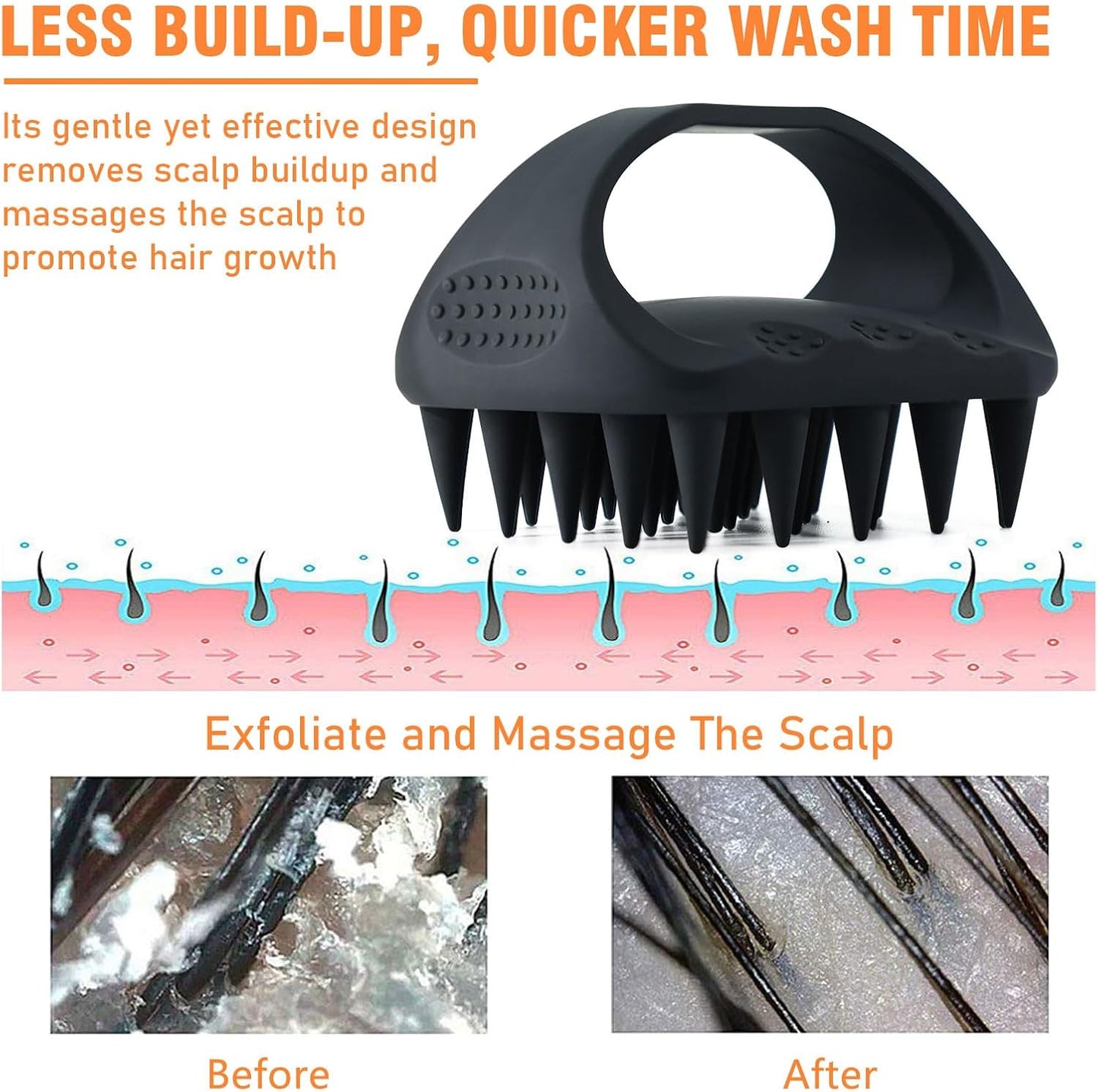Scalp Massager Shampoo Brush, Scalp Scrubber for Dandruff & Build Up, Scalp Massager Hair Growth - 100% Silicone, Plastic Free