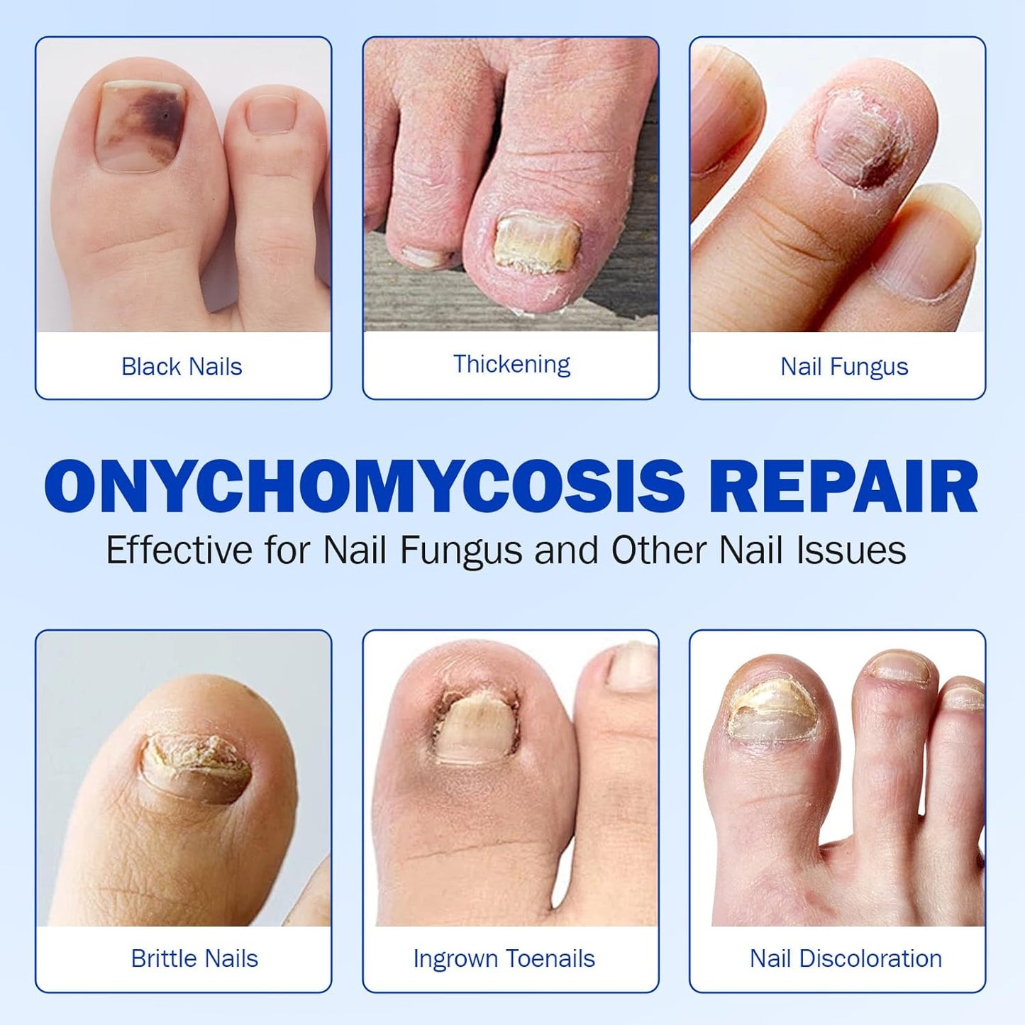 21 PCS Nail Patches ，Toenail Treatment Patch Extra Strength 8-Hour ，Nail Repair Patches,Nail Repair for Restores Damaged Nails and Appearance of Discolored，Overnight Renewal for Men and Women（2pack）