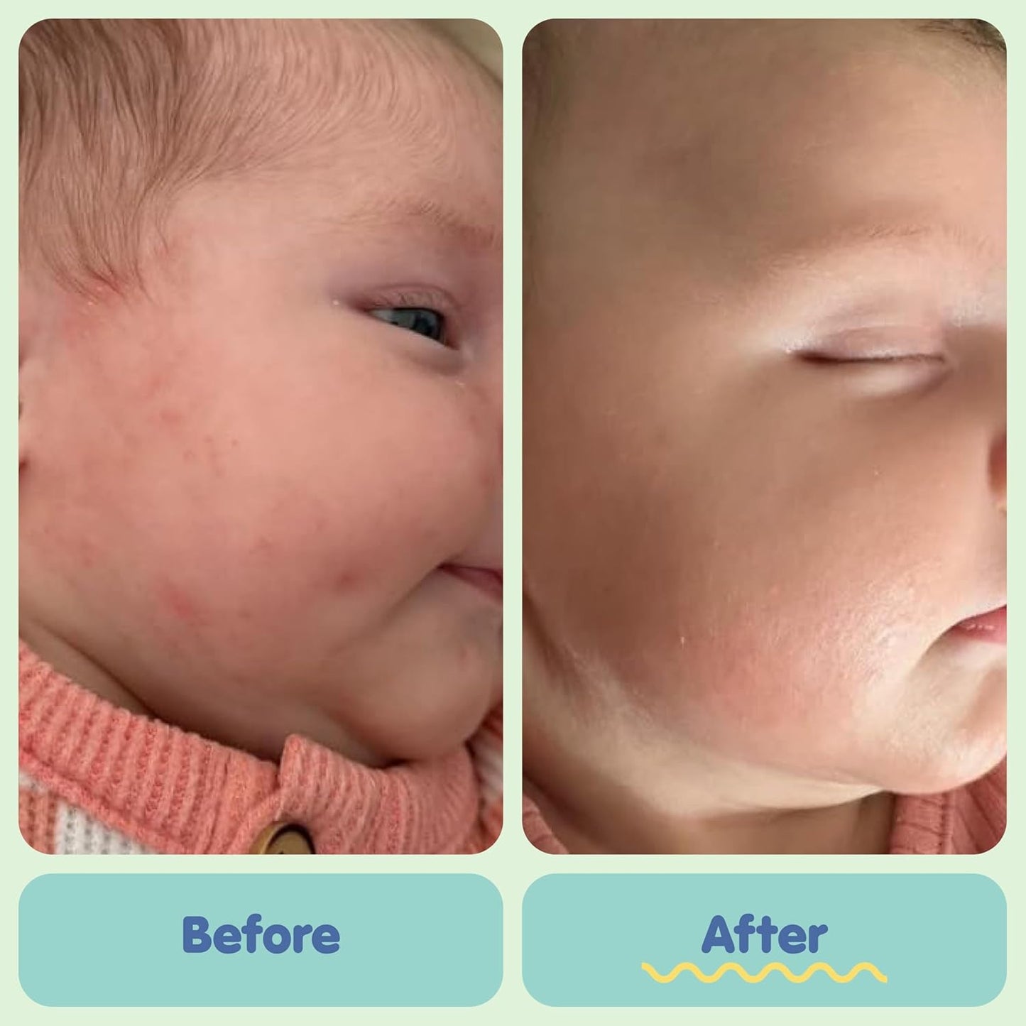 TUBBY TODD All Over Ointment Baby Eczema Cream, Everyday Multi-Purpose Baby Skin Relief Cream, Sensitive and Dry Skin, Rash & Irritation - Steroid & Gluten Free, Fragrance-Free, 8 oz, 2 Pack
