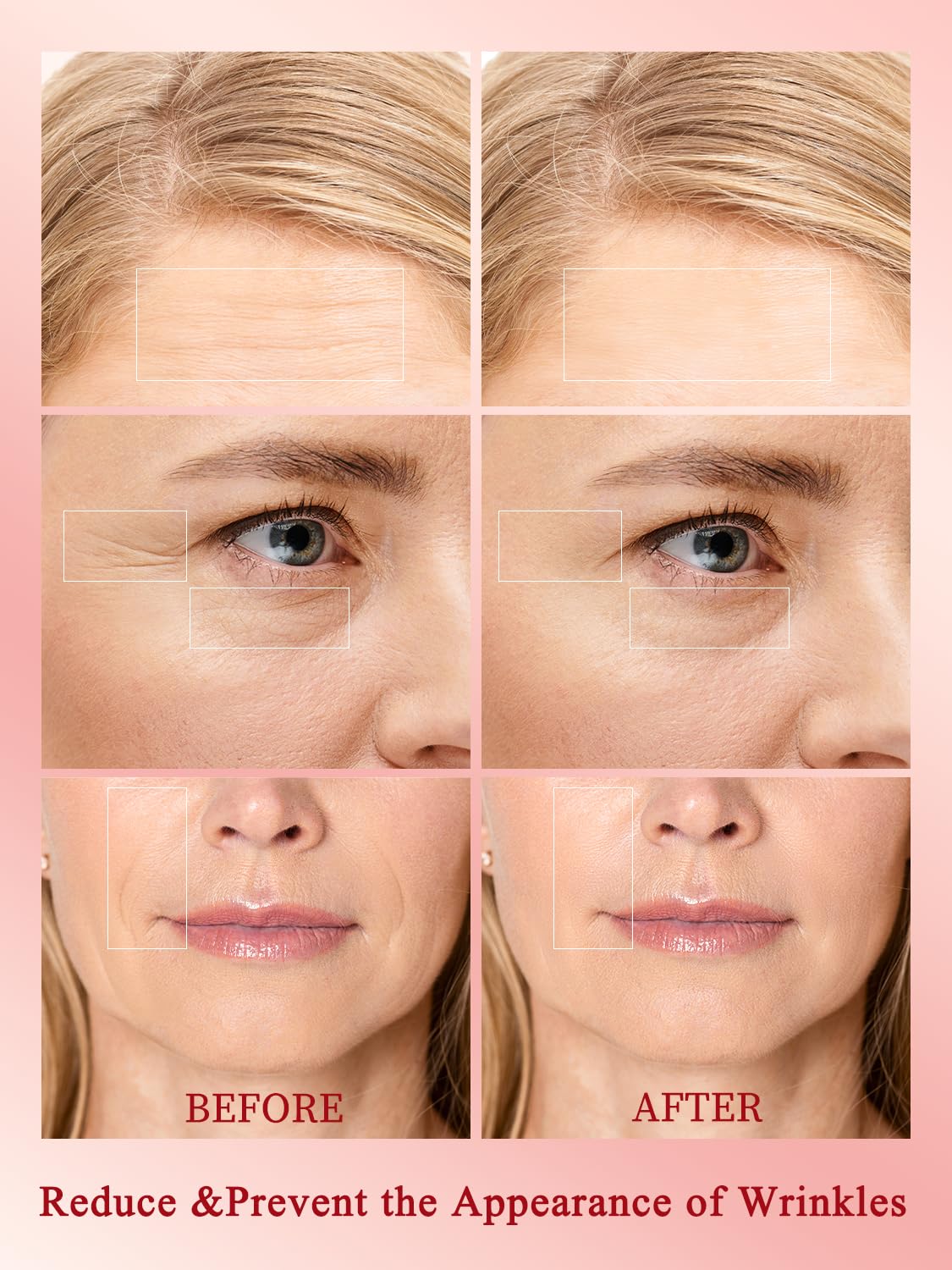 Radio Frequency Skin Tightening Device, Professional Wireless Home RF Skin Tightening Face Machine, 3 Levels for Smooth Fine Lines, Lifting, Firming