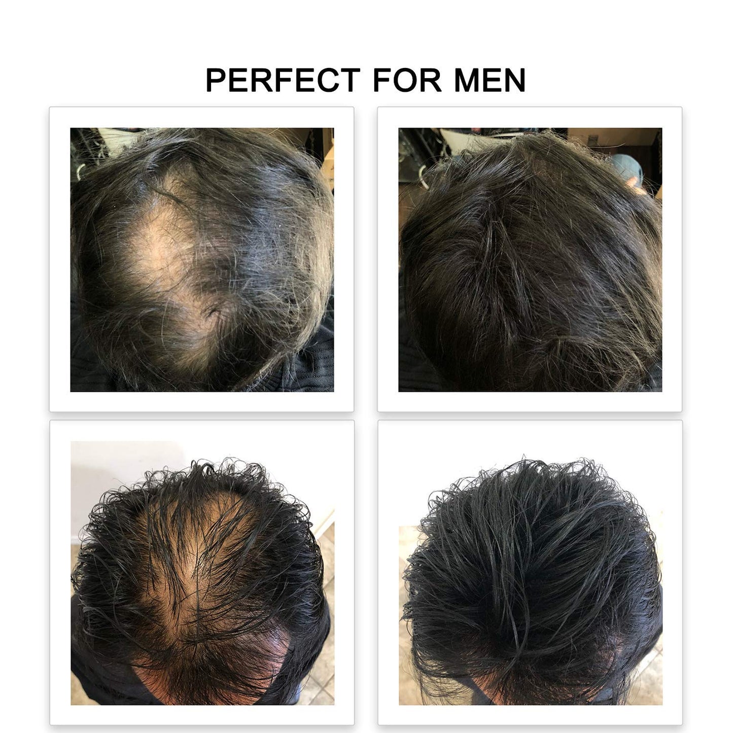 FEBRON Hair Fibers For Thinning Hair GRAY For Women & Men Hair Loss Concealer Hair Powder Volumizing Based 100% Undetectable & Natural - Bald Spots Filler (30 Gram, Gray)