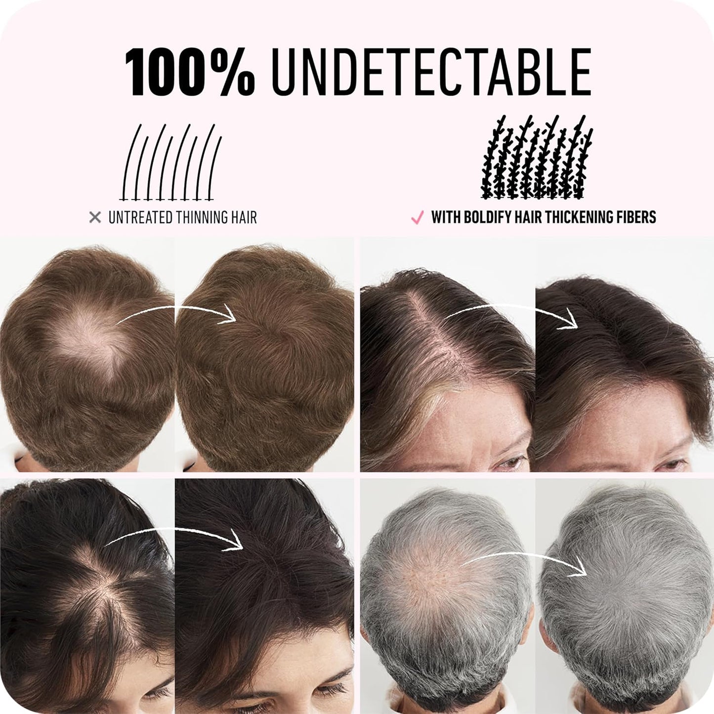 BOLDIFY Hair Fibers (28g) - Fill In Thinning and Fine Hair for an Instantly Fuller, Thicker Look - 14 Shades for Women & Men - Medium Brown