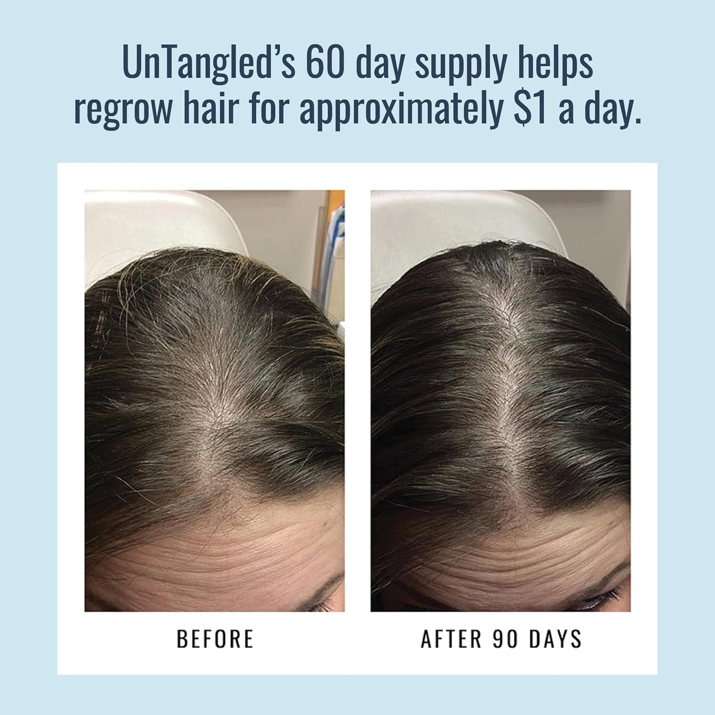 UnTangled Hair Vitamins (60-day supply) - Collagen & Biotin Supplement for Women & Men, Visibly Thicker, Faster Hair Growth