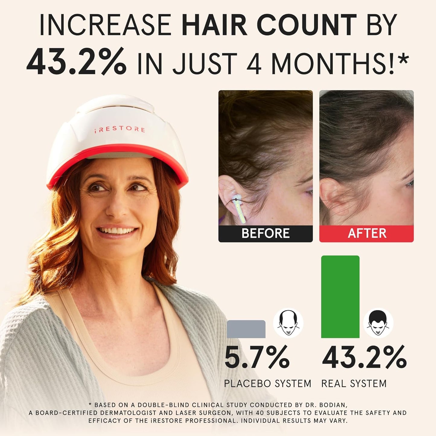iRestore Professional Laser Red Light Therapy for Hair Growth System - FDA Cleared Hair Loss, Hair Thinning & Alopecia Treatment for Men & Women - 282 Lasers & LEDs