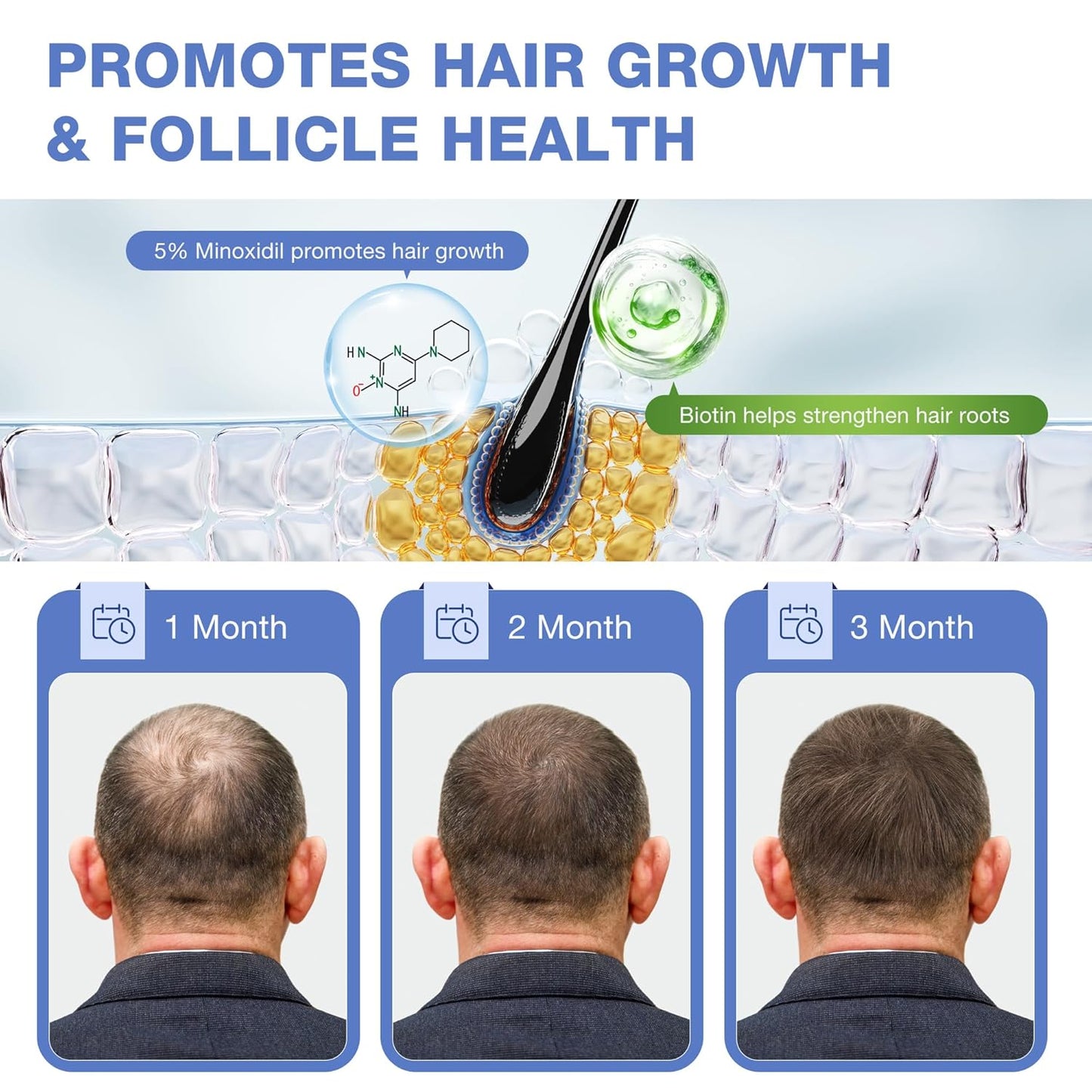 5% Minoxidil for Men Hair Growth Serum - Minoxidil for Women Serum with Biotin for Thicker & Healthier, Topical Minoxidil for Men Restore Fuller Beard