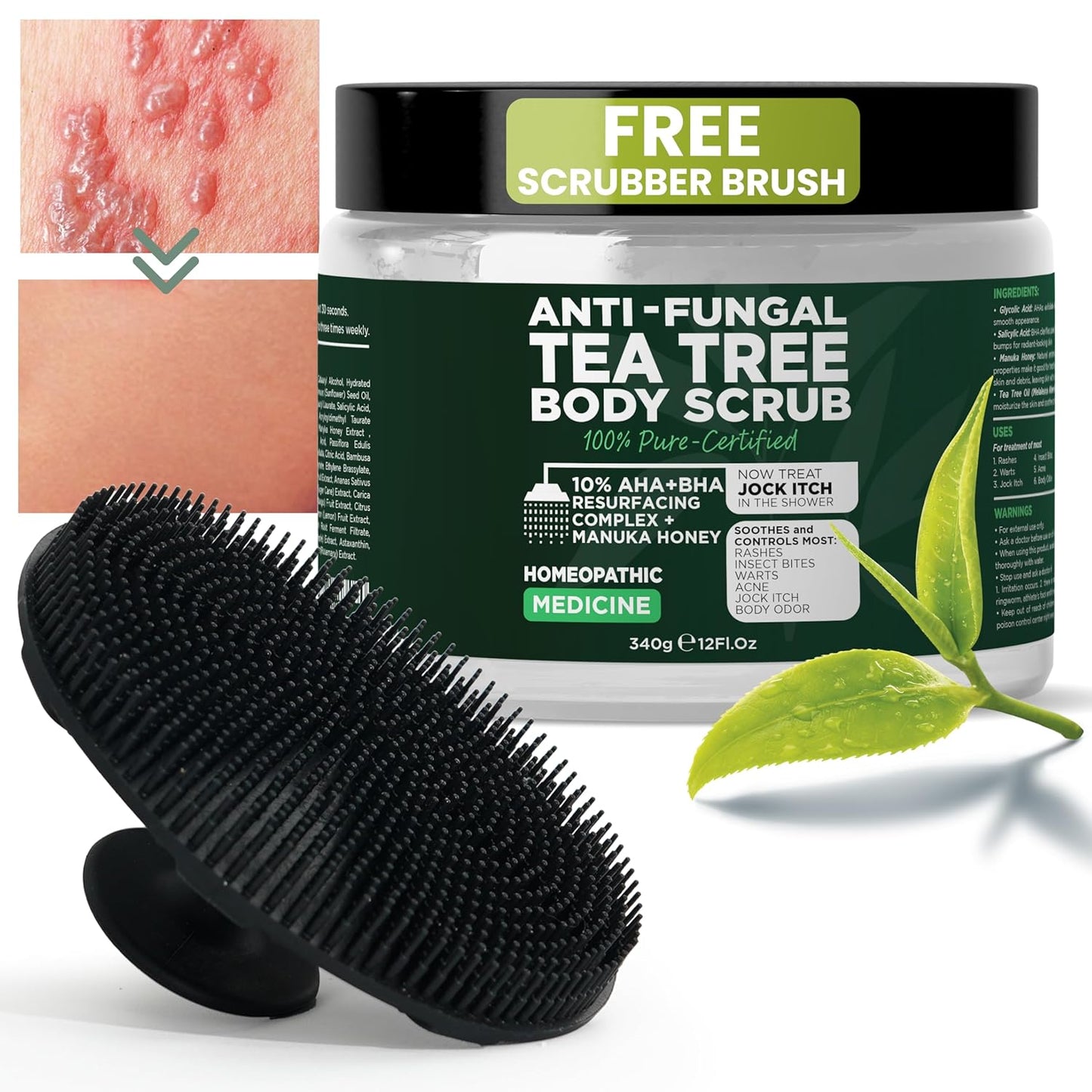 Terramed Just Think Comfort Antifungal Body Scrub with Tea Tree Oil – Exfoliating Body Wash for Women & Men – Soothes Itchy Skin, Rashes, Acne, Warts & Insects Bites – 12 Fl oz with Scrubber Brush