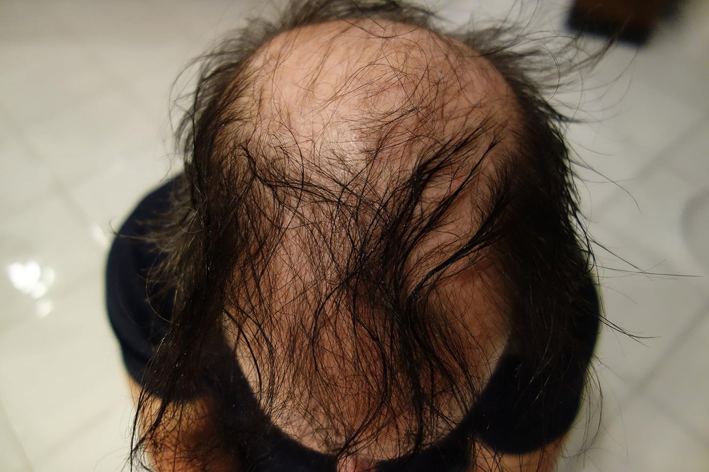 Hair Building Fibers 100 Grams Refill Your Existing Bottle. Highest Grade Fiber By Finally Hair (Grey & Pepper Dark (dark grey with highlights))